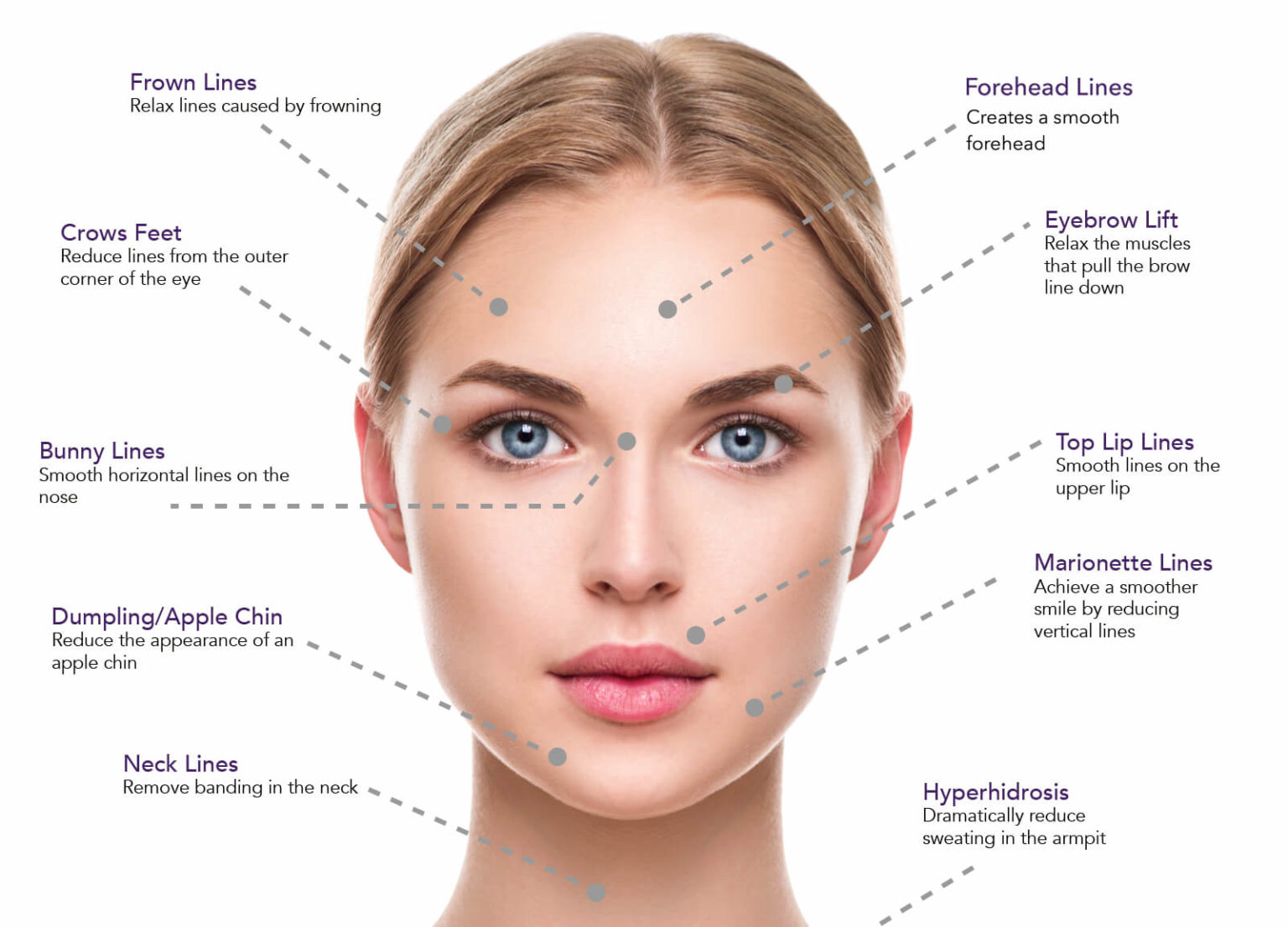 Botox Injections in Calgary